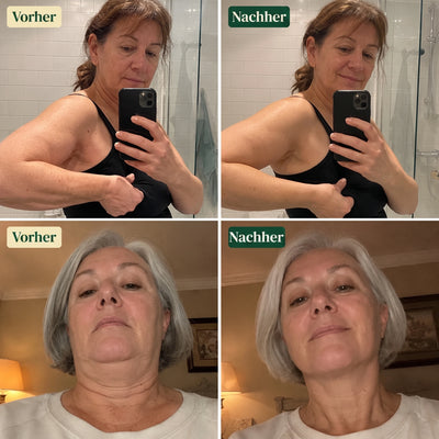 Lymphdrainage - Kräutertropfen für ein leichtes Körpergefühl