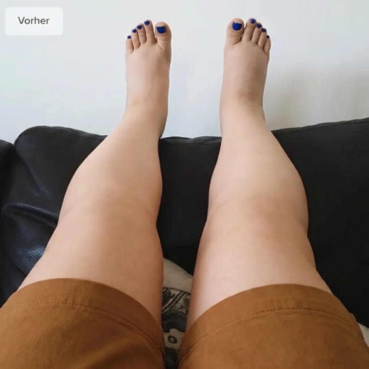 Vorher