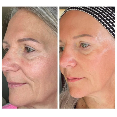 Spazzola Viso Skulpt Linfatica per Contouring