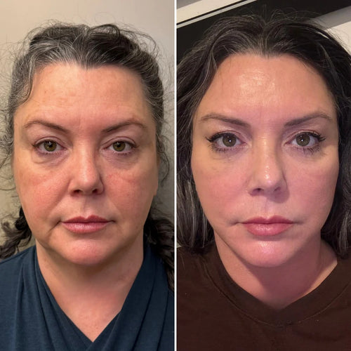 Spazzola Viso Skulpt Linfatica per Contouring